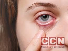 Don’t ignore pesky eye infections – some can cause blindness, even death. Learn how to identify, treat, and prevent them in this comprehensive guide.